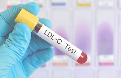 LDL-cholesterol: is 3,4 gevaarlijk of niet? Dit is hoe het écht zit