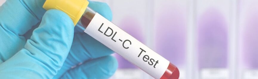 LDL-cholesterol: is 3,4 gevaarlijk of niet? Dit is hoe het écht zit