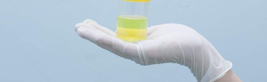 Leukocyten in urine zonder pijn: wat kan dat betekenen?