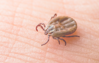 Tekenbeet zonder rode ring: dit betekent het voor Lyme