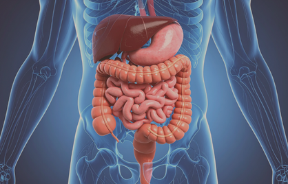 FODMaP dieet voor SIBO: Wat kun je tegen bacteriën in je darm doen?