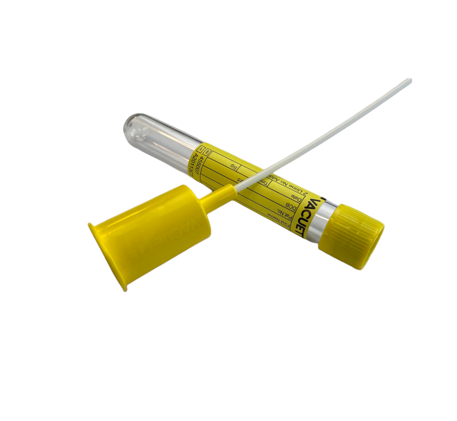 cadmium urine