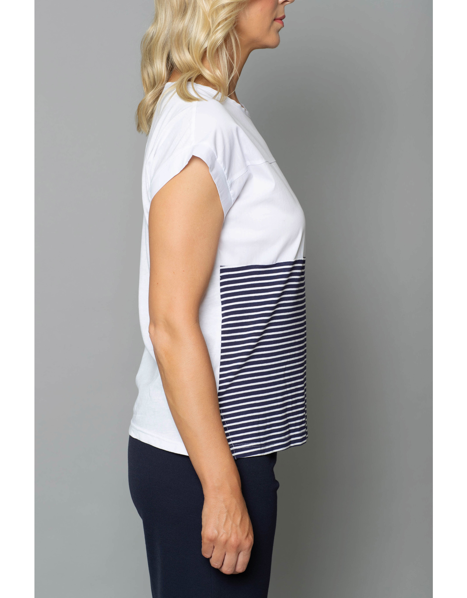 Peruzzi Stripe Top