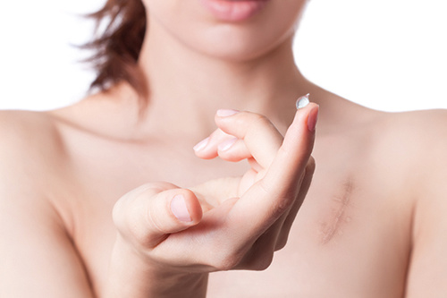 Wat is belangrijk bij littekenzalf?