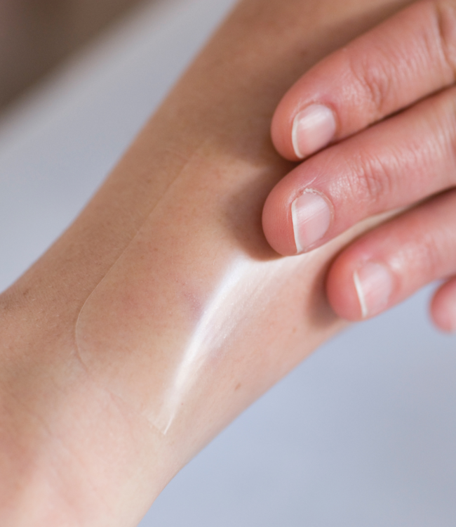 BAPSCARCARE T scar silicone plaster extra thin