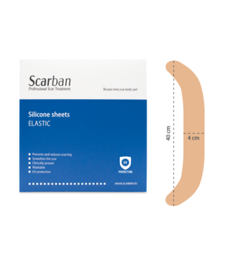 Scarban Elastisches Narben-Silikonpflaster am Bauch