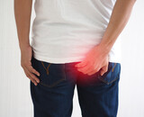 Was ist eine Hämorrhoide?