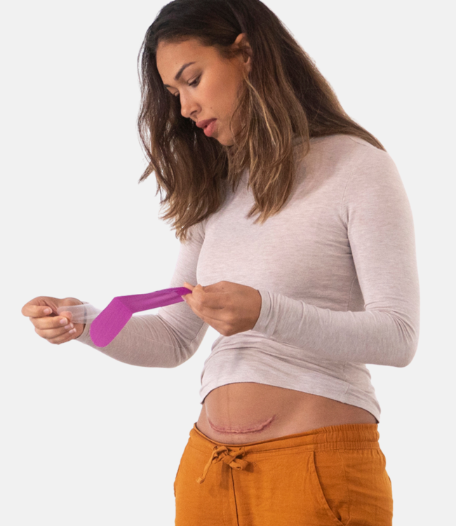 Scarban C-Section litteken siliconenpleister