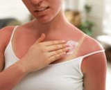 Verbrand door de zon: wat te doen?