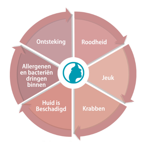 Vicieuze krab cirkel bij eczeem