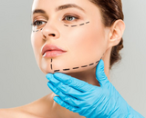 Facelift littekens: zijn ze zichtbaar en wat kun je doen?