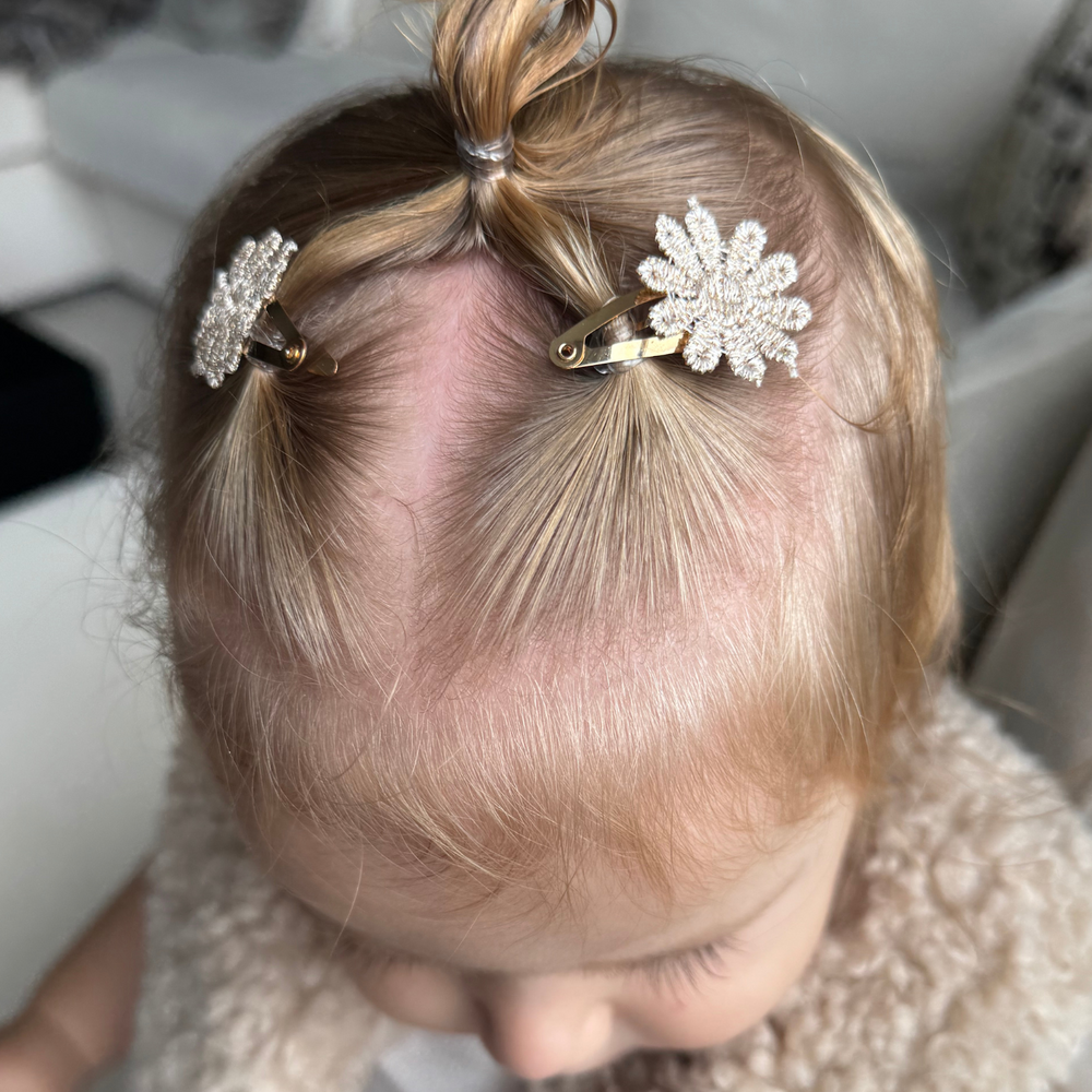 Your Little Miss Haarspangen Jade - Golden glow