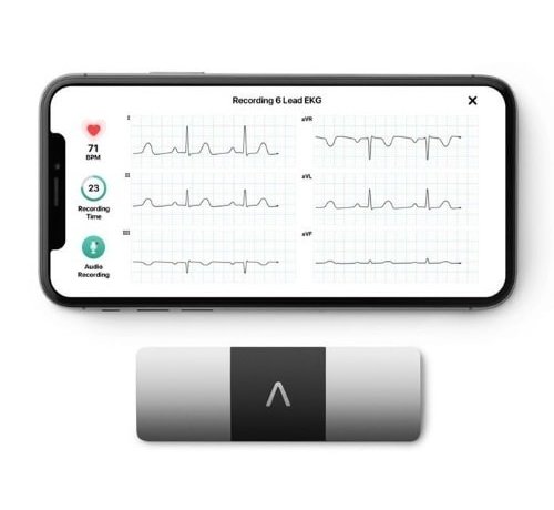 AliveCor Kardia Mobile 6L ECG