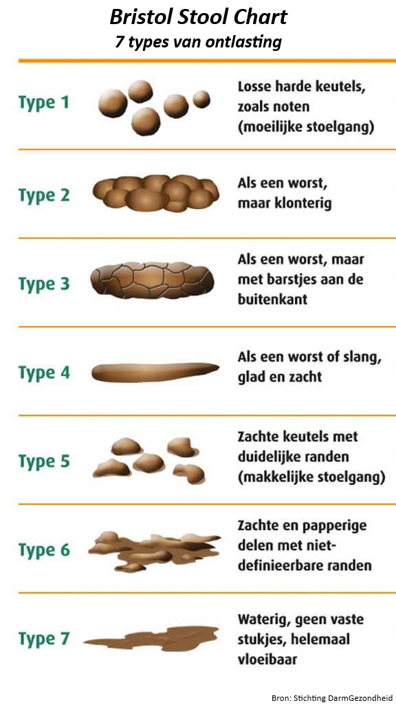 Overzicht van de Bristol Stool Chart met zeven types ontlasting