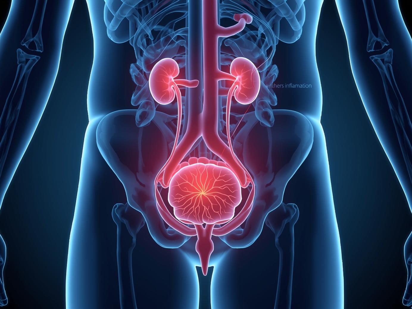 Medische illustratie van de urinewegen met focus op blaas en urinebuis bij infectie