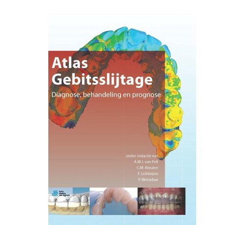 Atlas gebitsslijtage - Nieuw exemplaar