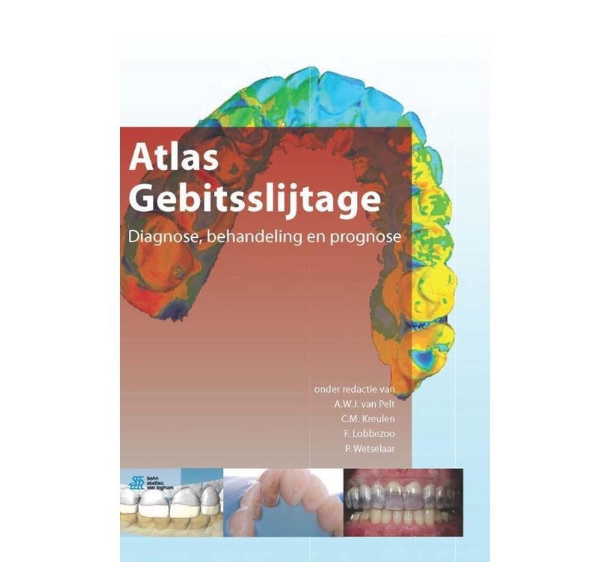 Atlas gebitsslijtage - Nieuw exemplaar