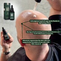 Anti-Pigment Bald Serum (0-6mm) 50ml