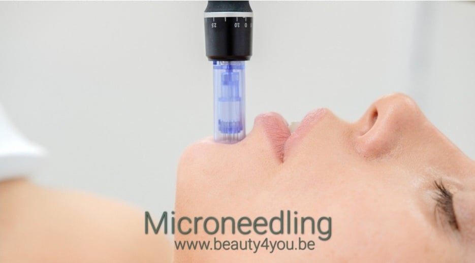 Microneedling huidverbetering