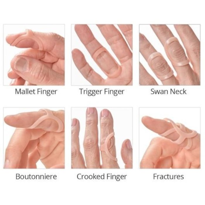 Finger splint Oval 8 splint - Set of 3