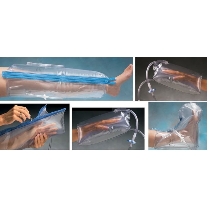 Urias®-Johnstone splint child