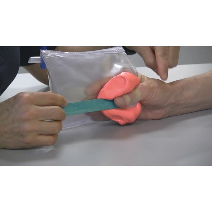 Urias®-Johnstone splint for finger (single chamber)