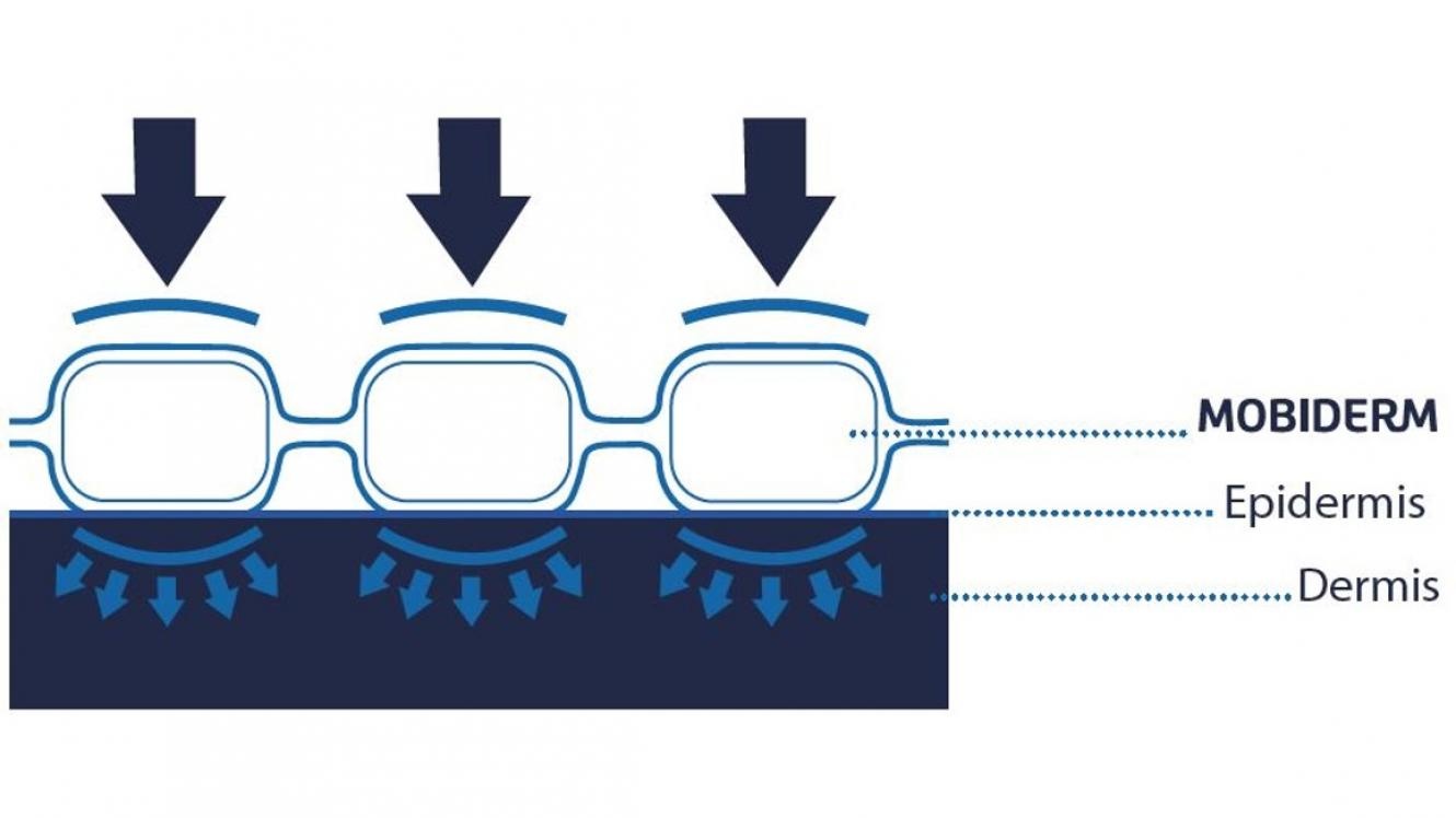 Chaussettes Mobiderm pour lymphoedème