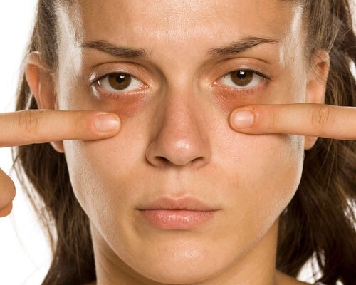 Last van wallen? Dít kun je eraan doen