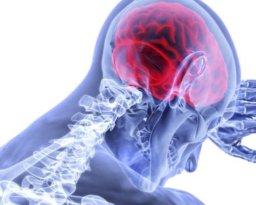 Prévenir les accidents vasculaires cérébraux : Apprenez les signes d'alerte !