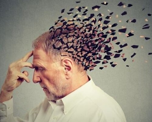 Early-stage Alzheimer's disease: Recognizing Symptoms in Younger Patients