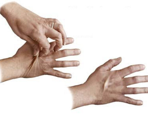 Uitdroging: Symptomen en Wat te Doen