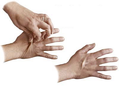 Uitdroging: Symptomen en Wat te Doen