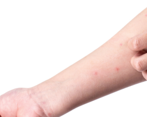 Alles wat je moet weten over de eikenprocessierups