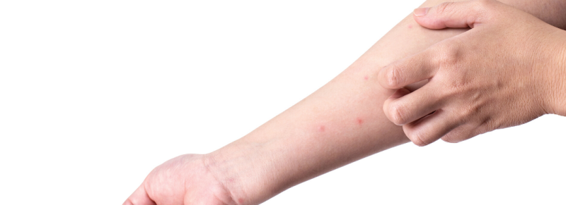 Alles wat je moet weten over de eikenprocessierups