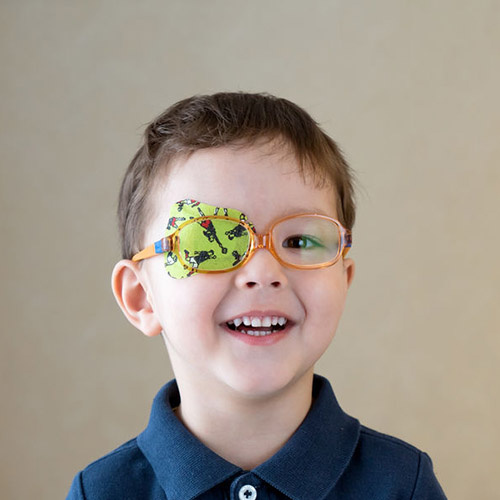 Lui oog (Amblyopie): Veelvoorkomend maar Onderbehandeld