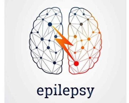 Syndroom van Lennox-Gastaut: Een ernstige vorm van epilepsie bij kinderen