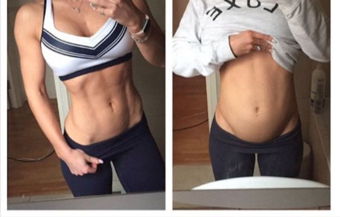 Mogelijke Oorzaken van een Opgezwollen Buik