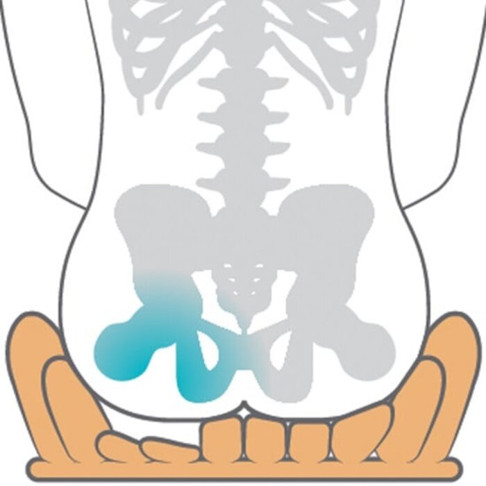 Coussin anti-escarres Etac Starlock, à cellules d'air fluctuantes