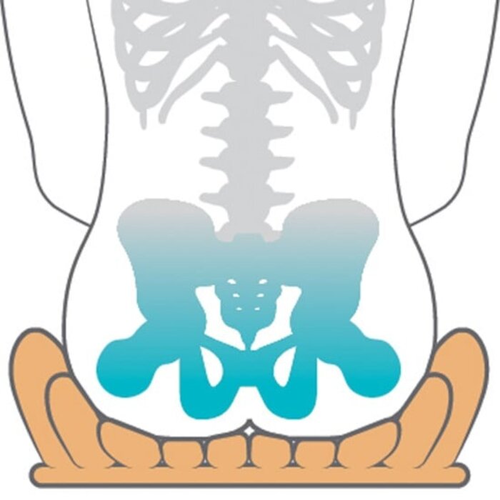 Coussin anti-escarres Etac Starlock, à cellules d'air fluctuantes