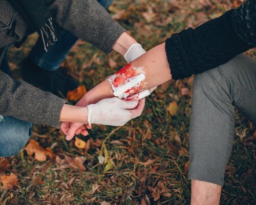First Aid for Burns: Cooling with Water