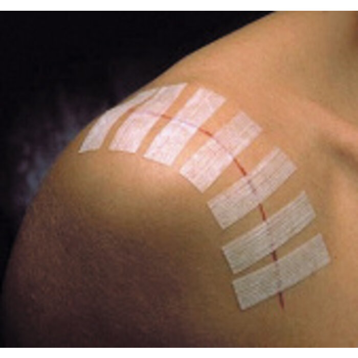 3M Steri-Strip adhesive strips