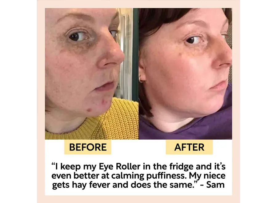 - Combo Eye Roller et Crème Contour des Yeux - Apaisant