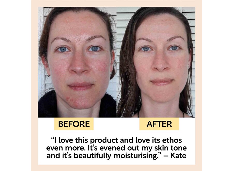 Sérum – Huile de café recyclée – Huile de cynorrhodon – 10 ML