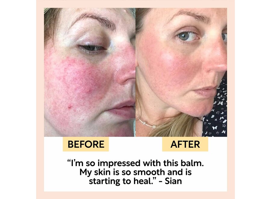 UpCircle - Cleansing Face Balm - Upcycled Aprikosenpulver - Haveröl & Vitamin E - 20 ML - Hautschonend - Vegan und tierversuchsfrei