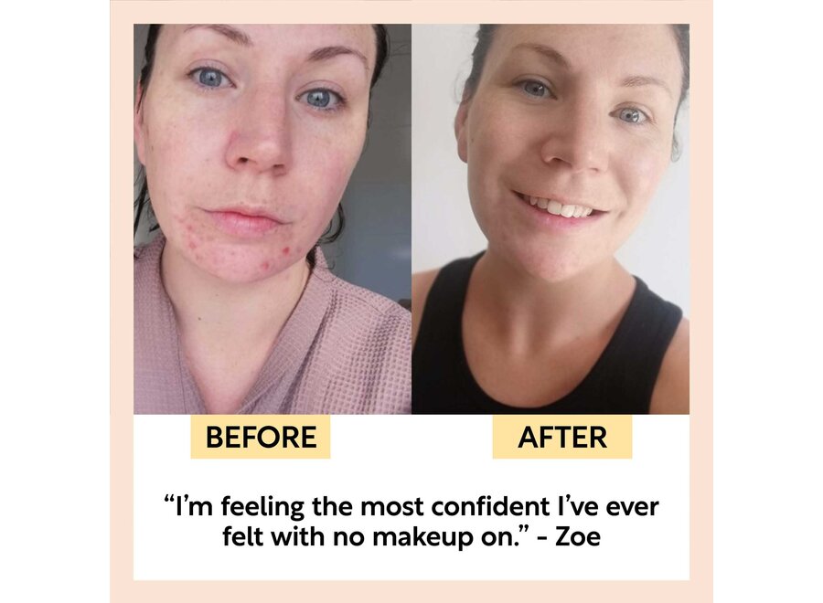 UpCircle Zonnebrand crème - SPF 25 – Upcycled frambozen – Face - UVA & UVB Filters - 60 ML