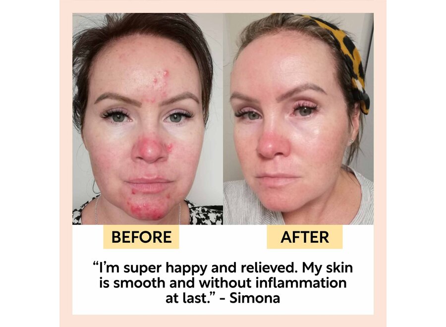 UpCircle Night Cream – Hyaluronic Acid & Niacinamide – 55 ml