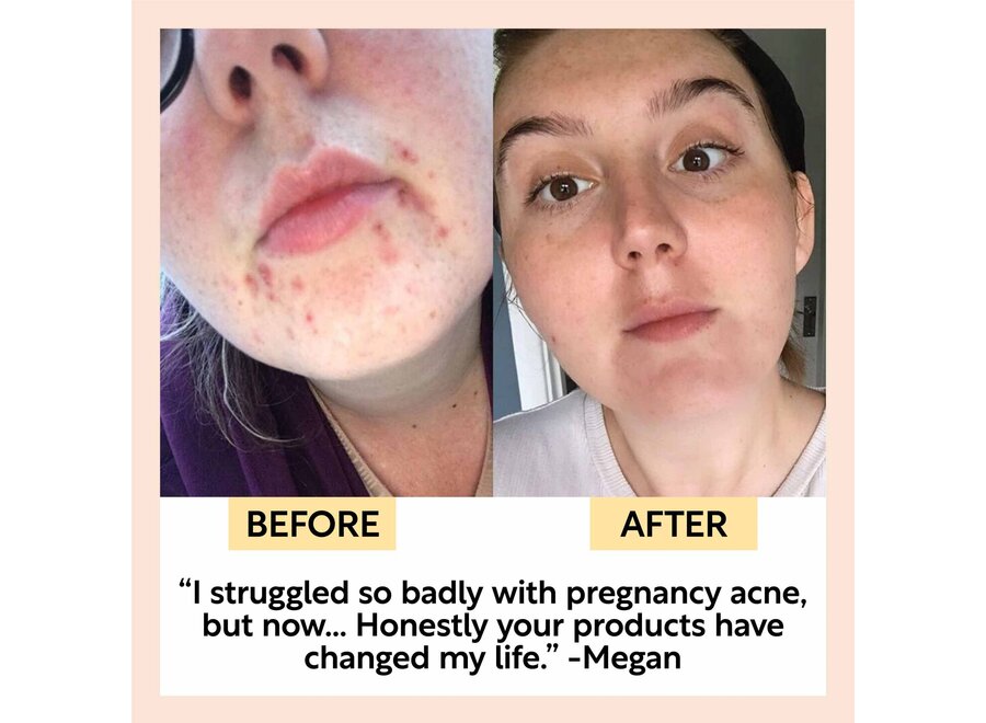 UpCircle - Feuchtigkeitscreme - Upcycled Arganpulver - Vitamin E & Aloe Vera - 60 ML - Vegan und plastikfrei - Natürliche Hydratation für jeden Tag