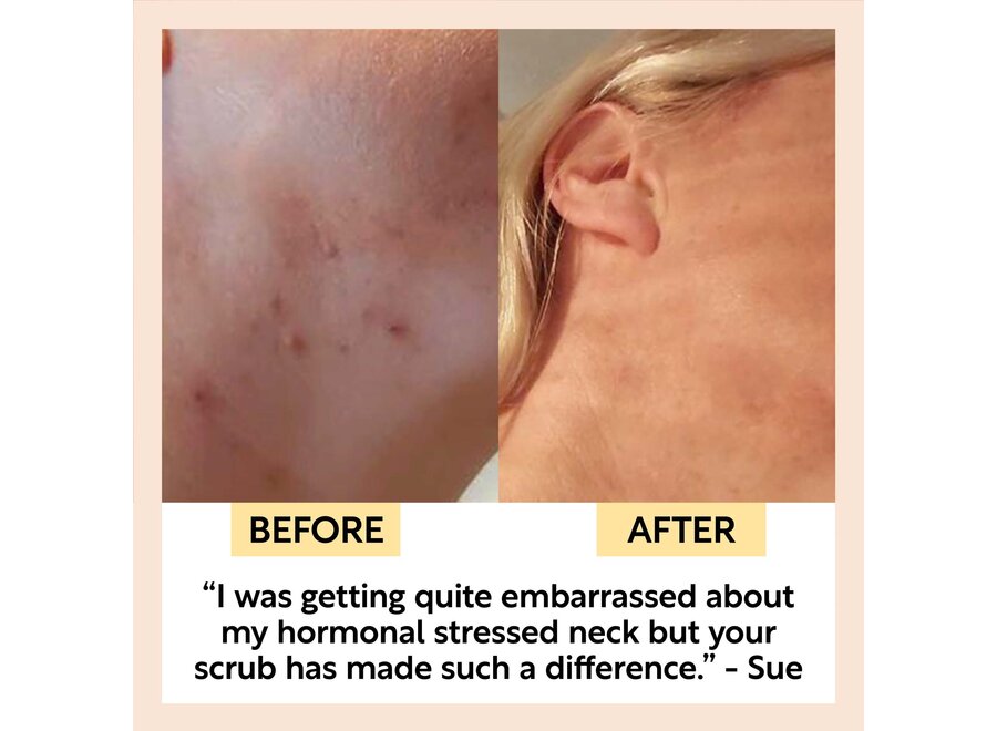 UpCircle Face Scrub - Upcycled Coffee Grounds – Coffee & Rosehip Oil - Citrus Blend - 100 ML