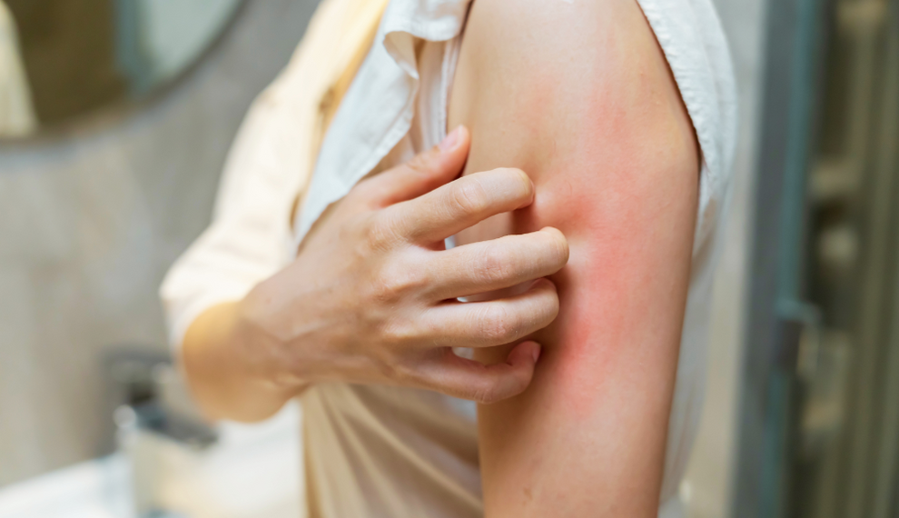 Skin allergy: what is it, how do you recognize it, and how do you choose products that are safe?