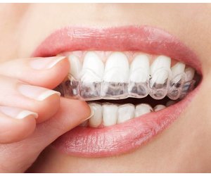 Wissen mooi virtueel DentalStore Anti knarsbitje (volwassenen) - MouthGuard Gebitsbescherming